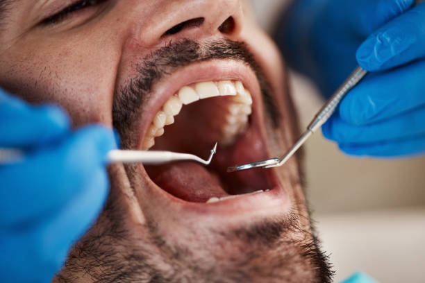 Best Chipped Tooth Repair Near Me  in Locust Fork, AL